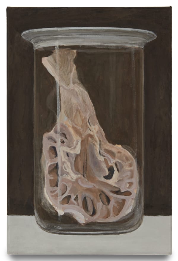 Christoph Hänsli, Feuchtpräparat Nephrolithiasis, 2022