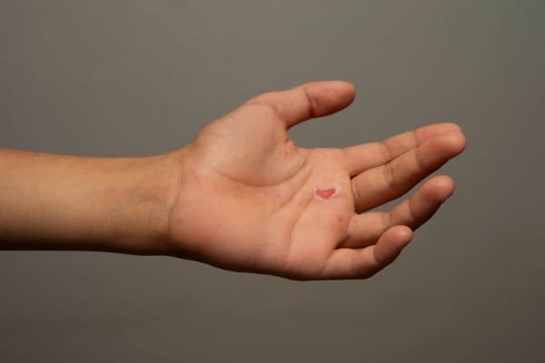 Chih-Chien Wang, Hand with Wound, 2023