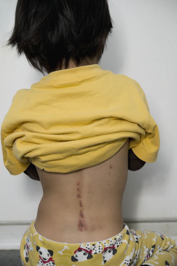 Chih-Chien Wang, Wound, 2014