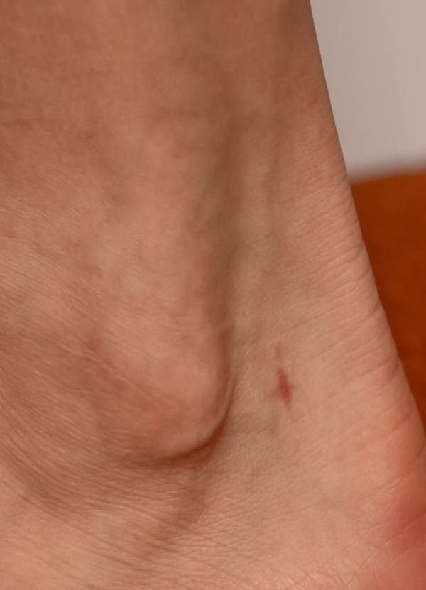 Nicole Wilson Ötzi: Tattoo Design T_11, 2021