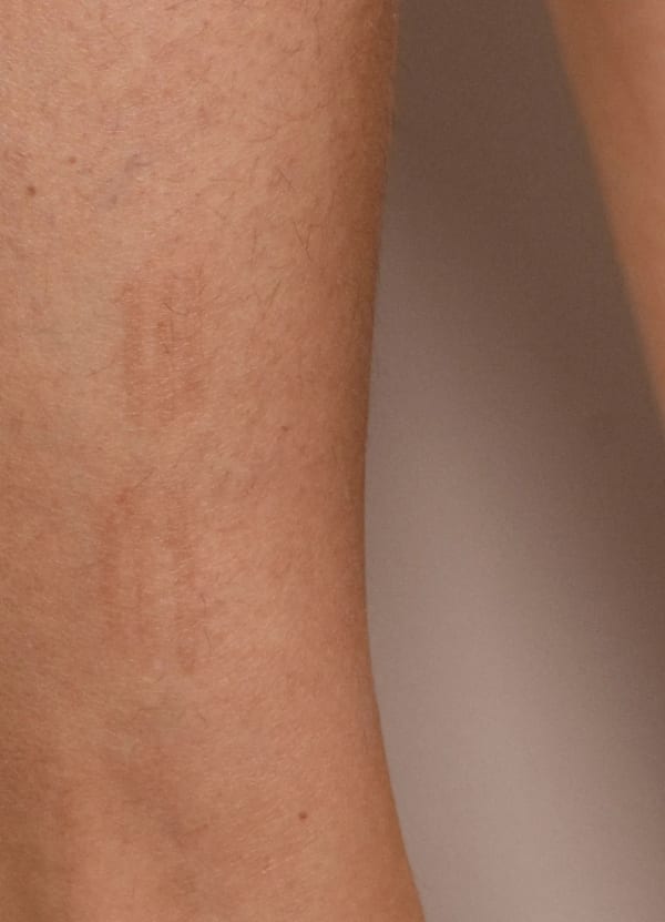 Nicole Wilson Ötzi: Tattoo Design T_12, 2021