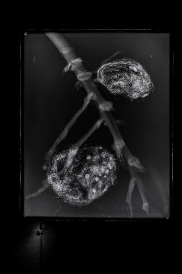 Prajakta Potnis He Woke Up With Seeds In His Lungs 2, 2020 X-Ray Film In Led Light Box 15 x 12 inches