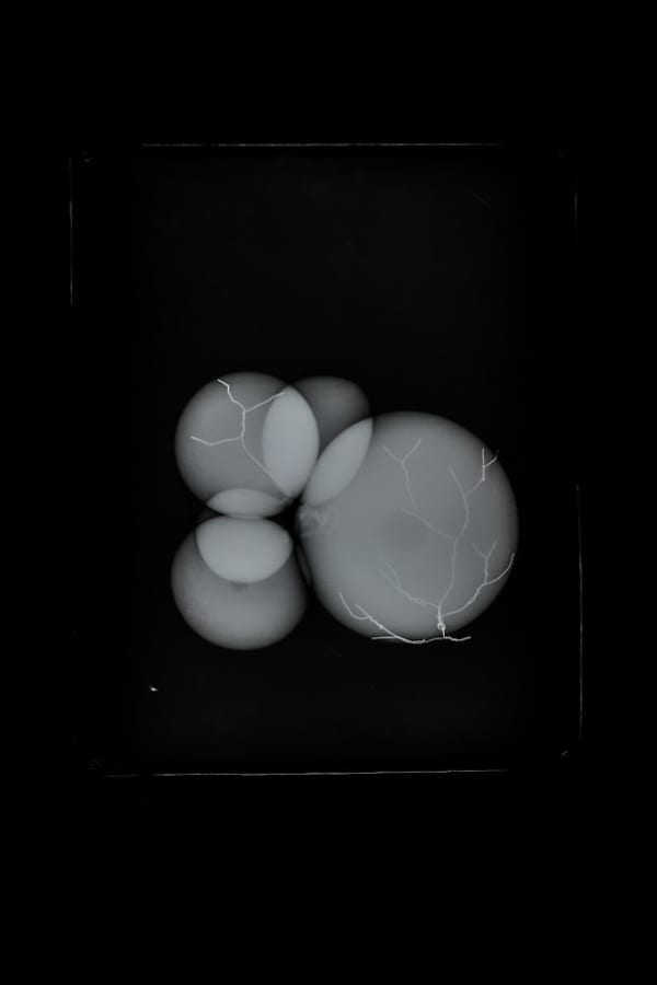 Prajakta Potnis He Woke Up With Seeds In His Lungs 3, 2020 X-Ray Film In Led Light Box 15 x 12 inches