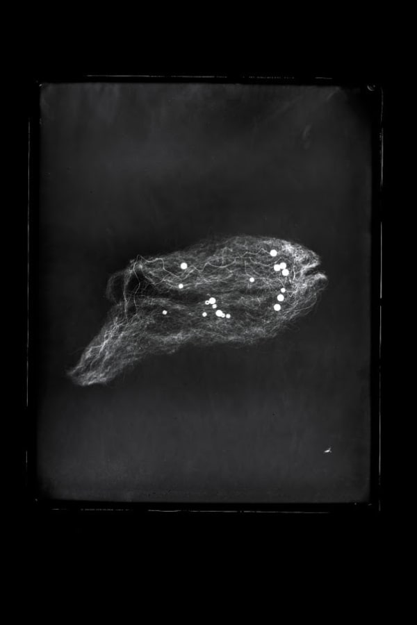 Prajakta Potnis He Woke Up With Seeds In His Lungs 1, 2020 X-Ray Film In Led Light Box 15 x 12 inches
