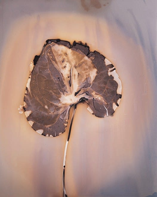 Anaïs Tondeur, Morning Glory Ercolano, Vesuvius, former dump Ammendola Formisano, Terra dei Fuochi, Italy, 2024 - 2025