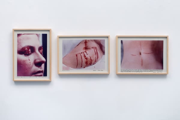 Gina PANE, Psyché [Psyche], 1974