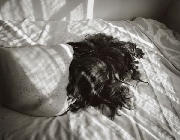 Jo Ann Callis, Untitled, [freckles and beets] from the Early Black and White Portfolio, Circa Early 1970's