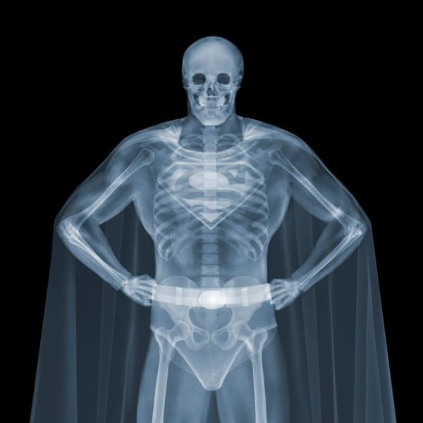 Nick Veasey, Superman, 2014