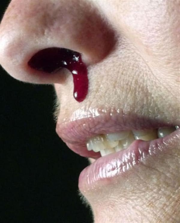 Kevin Capon Nose Bleed, 2011 C-type print (ed of 8) 91.0 x 75.0 cm