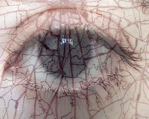Myopia, 2008