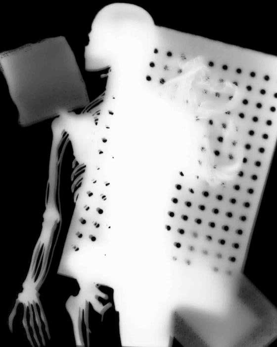 Rheumatology, 2007