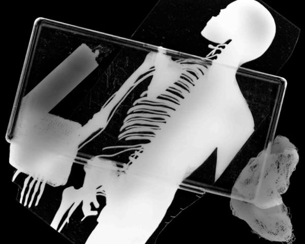 Rib Cage, 2007