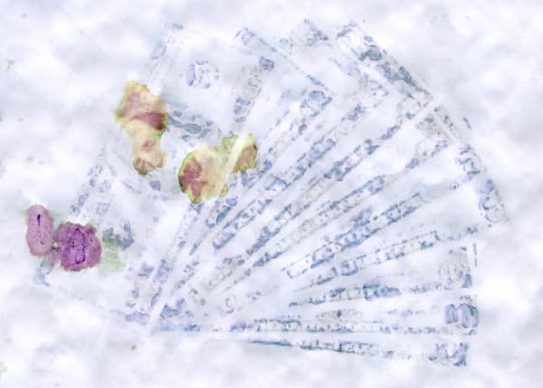 Bills (Watermelon Radish)