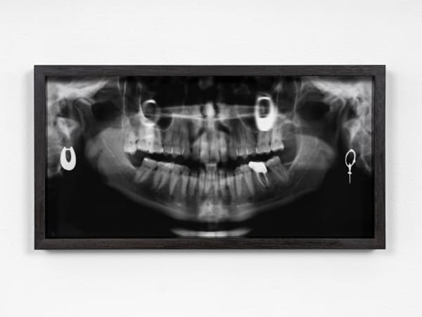 Hvis verden spør, så er svaret nei #5