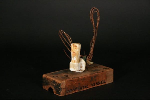 Lymphatic Vessel I, 2008
