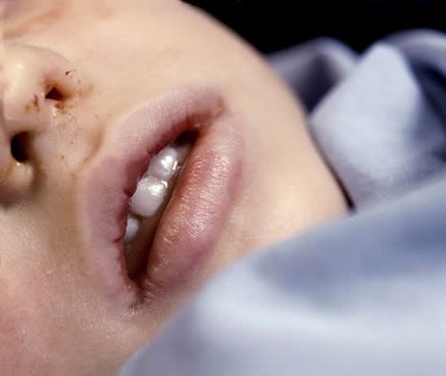 Andres Serrano, The Morgue (Pneumonia Due To Drowning II), 1992, cibachrome, 124 x 150 cm Courtesy of 20.21 Galerie Edition Kunsthandel GmbH, Essen