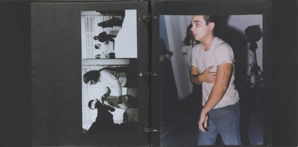 Photo album with two photos, one black and white, and one color of a man with a cut arm