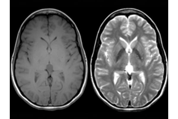 Insights Pineal Gland Daytime And Night Version