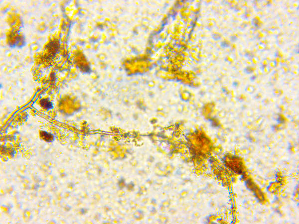 Fungal Hypha 5 X 400 Magnification
