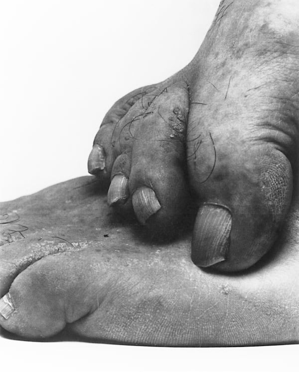 Installation view, John Coplans, Galerie Peter Kilchmann, Hardturmstrasse, Zurich, Switzerland, 1993