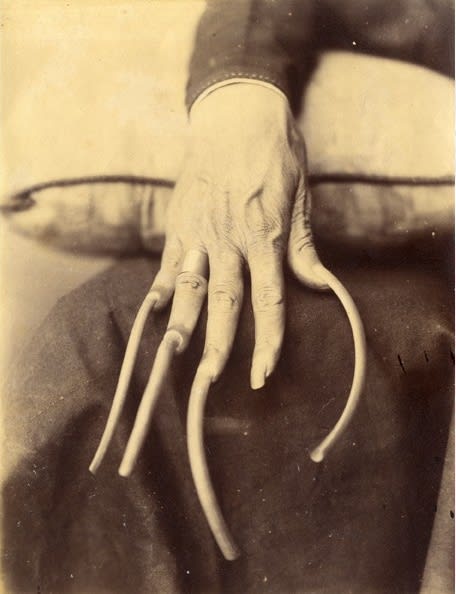 Hand of an Amanite man, 1880s, © Pierre Spake image 11 of 16