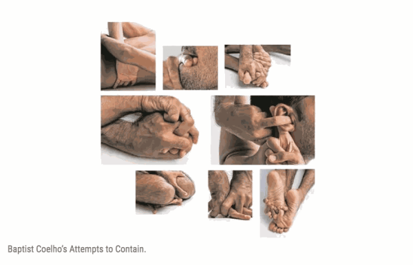 Black and White, Nine artists dig deep into the many layers of the skin in the exhibition titled ‘Skin: The...