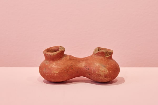 Guanacaste Conjoined Vessel