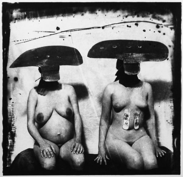 Joel-Peter Witkin, I.D. Photograph from Purgatory: Two Women with Stomach Irritations, New Mexico, 1982