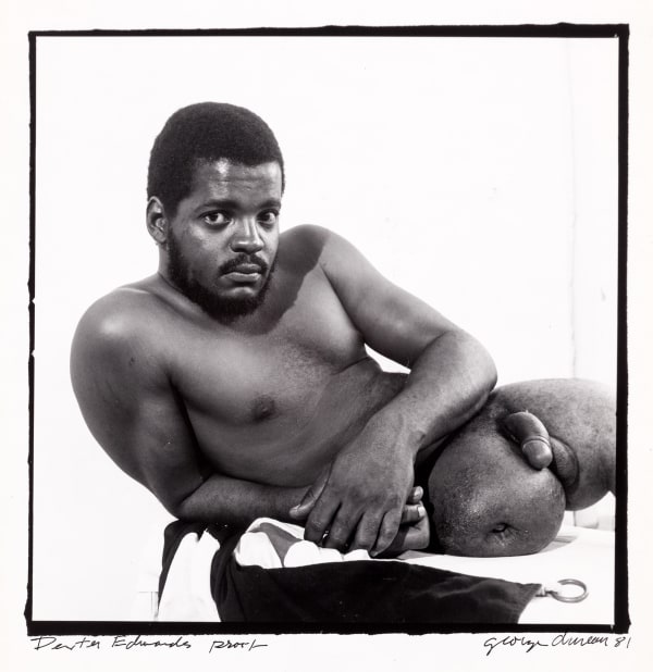 George Dureau, Dexter Edwards Proof (GDUR 1218), 1981