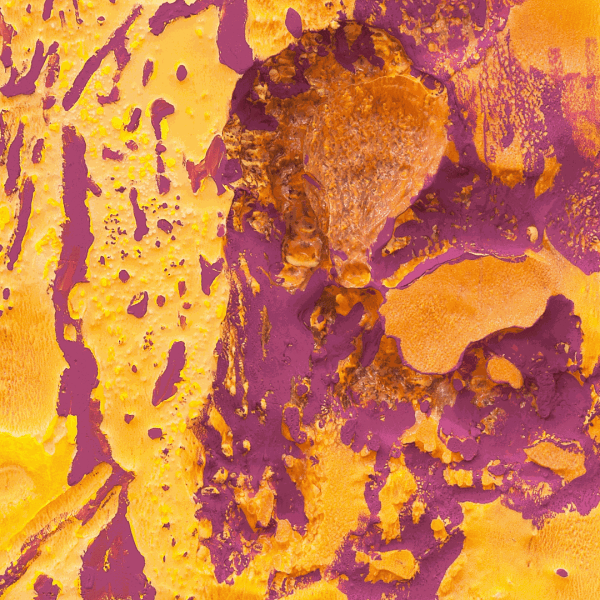 Anita MOLINERO, « Croûûûte criarde » (saison rose), 2016 (détail) ©Courtesy Galerie Christophe Gaillard