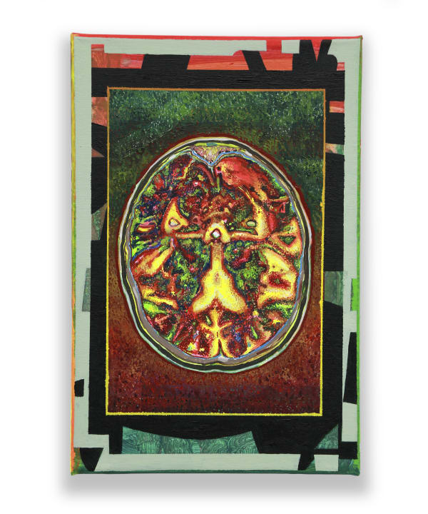 MRI 03 by Juanan Soria, 2025