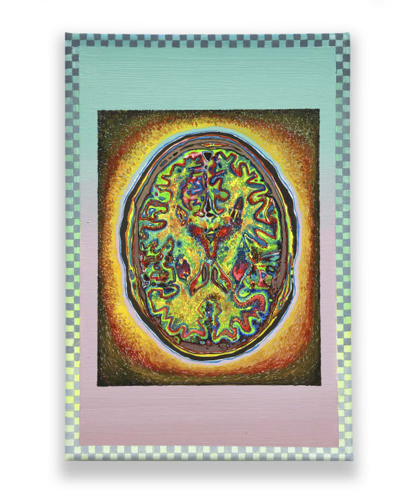 MRI 04 by Juanan Soria, 2025