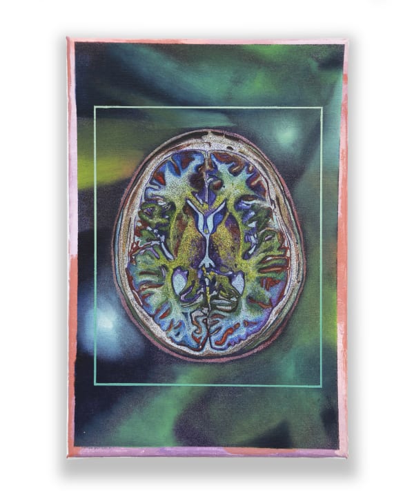 MRI 01 by Juanan Soria, 2024