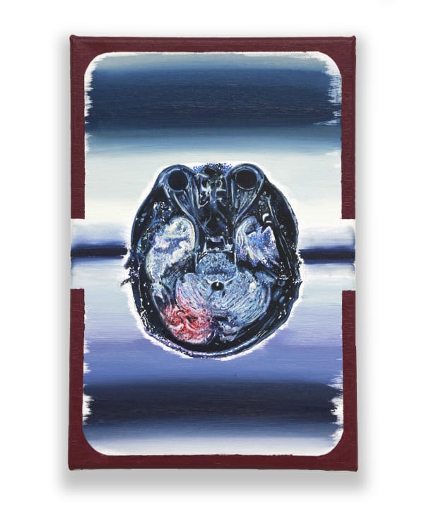 MRI 05 by Juanan Soria, 2025