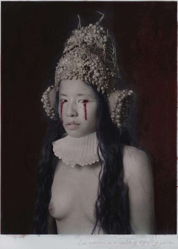 © Katie Eleanor, IV., EYE INFECTION AS A RESULT OF INGESTING POISON, Saint Wanderer's Hospital, 2015