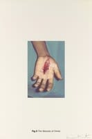 DAMIEN HIRST Fig. 5 The Wounds of Christ New Religion - The Wounds of Christ Silkscreen print on Somerset satin 410gsm Edition of 55 Signed and numbered Sheet: 100 x 66.7 cm 2005 Available only as part of the portfolio