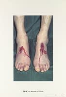 DAMIEN HIRST Fig. 6 The Wounds of Christ New Religion - The Wounds of Christ Silkscreen print on Somerset satin 410gsm Edition of 55 Signed and numbered Sheet: 100 x 66.7 cm 2005 Available only as part of the portfolio