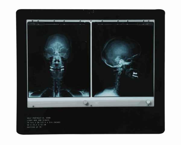 Damien Hirst, Self-Portrait X-Ray, 2010
