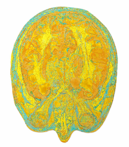 Stéphane Belzère, Grand IRM - pensées couleurs n°6, 2019-2020
