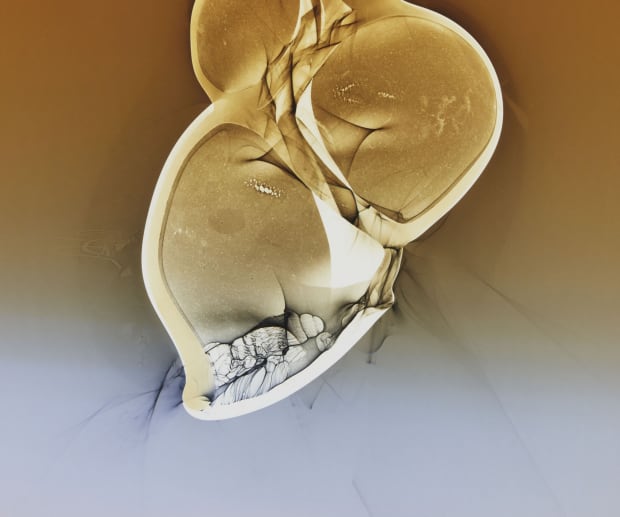 detail image of photo