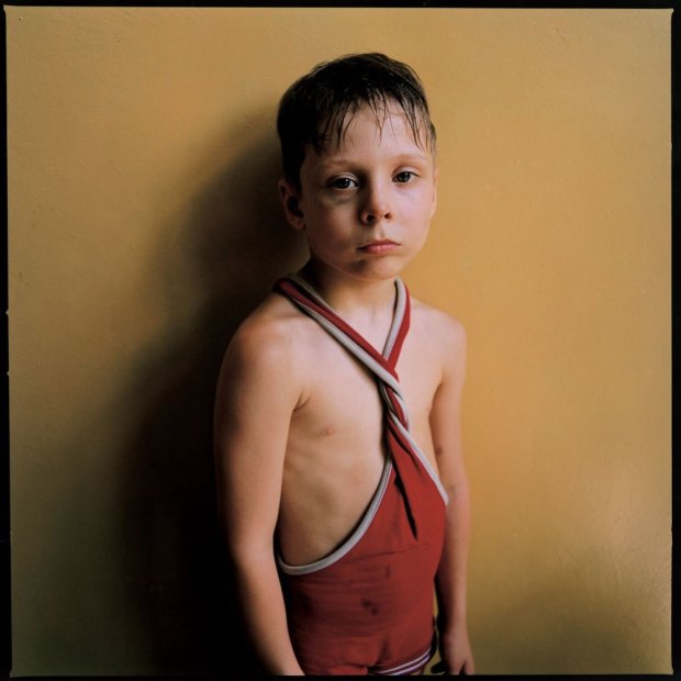 Michal Chelbin Black Eye, Ukraine chromogenic print 37 x 37 inches
