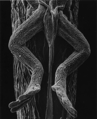 Claudia Fährenkemper, 115-01-8 Legs of a Tadpole, 40x, 2001