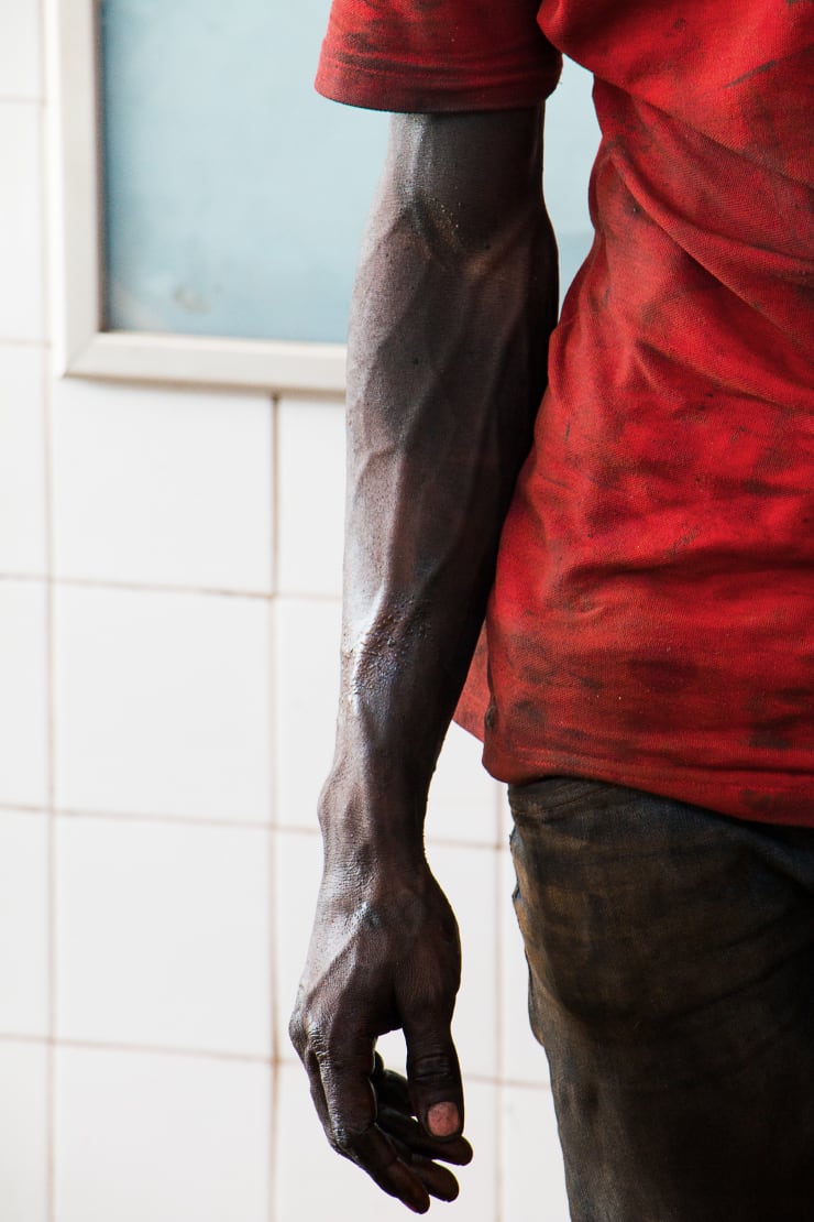 Ange-Frédéric Koffi, Arm, 2016