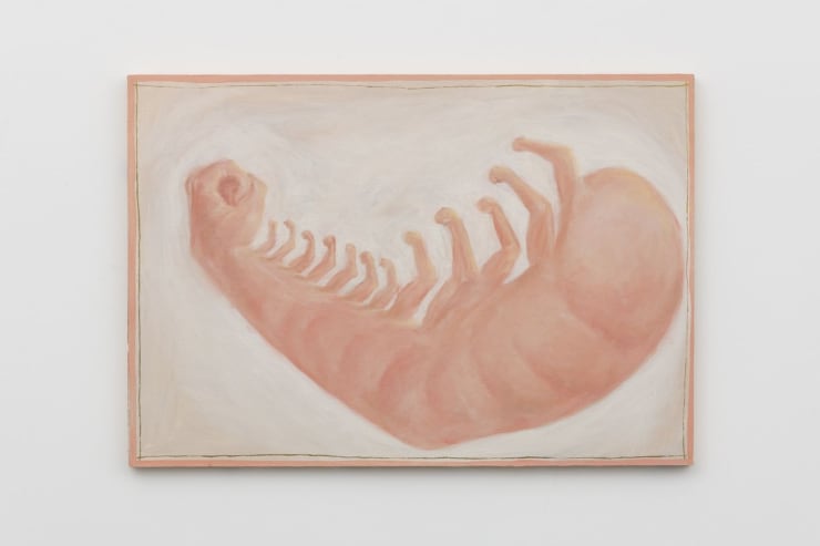 Tim Hawkinson, Martin (Muscle Flexing Shrimp Arm), 1995