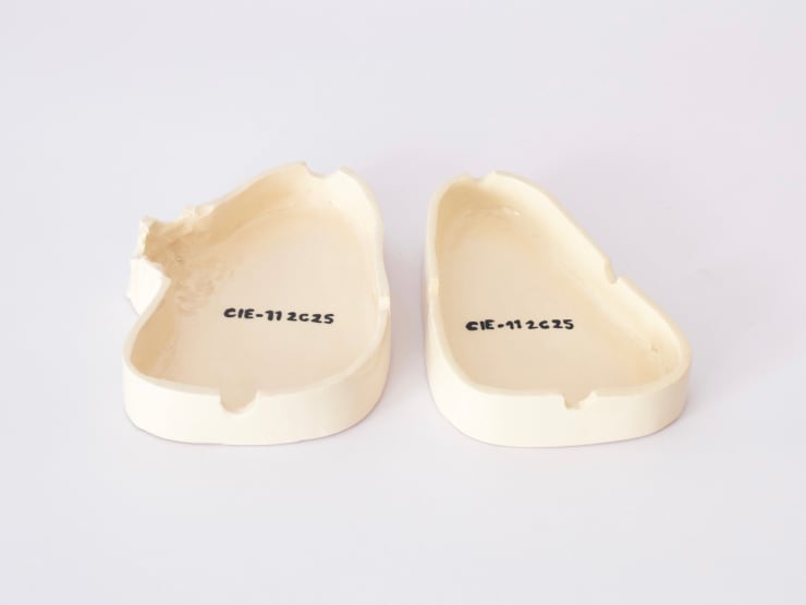 Pascual Ovalle, CIE-11 2C25 cáncer de pulmón (ICD11 2C25 lung cancer), 2024