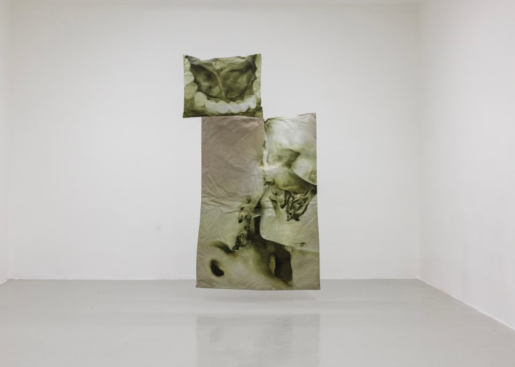 Der Geschmack von Metall. Erstick daran.