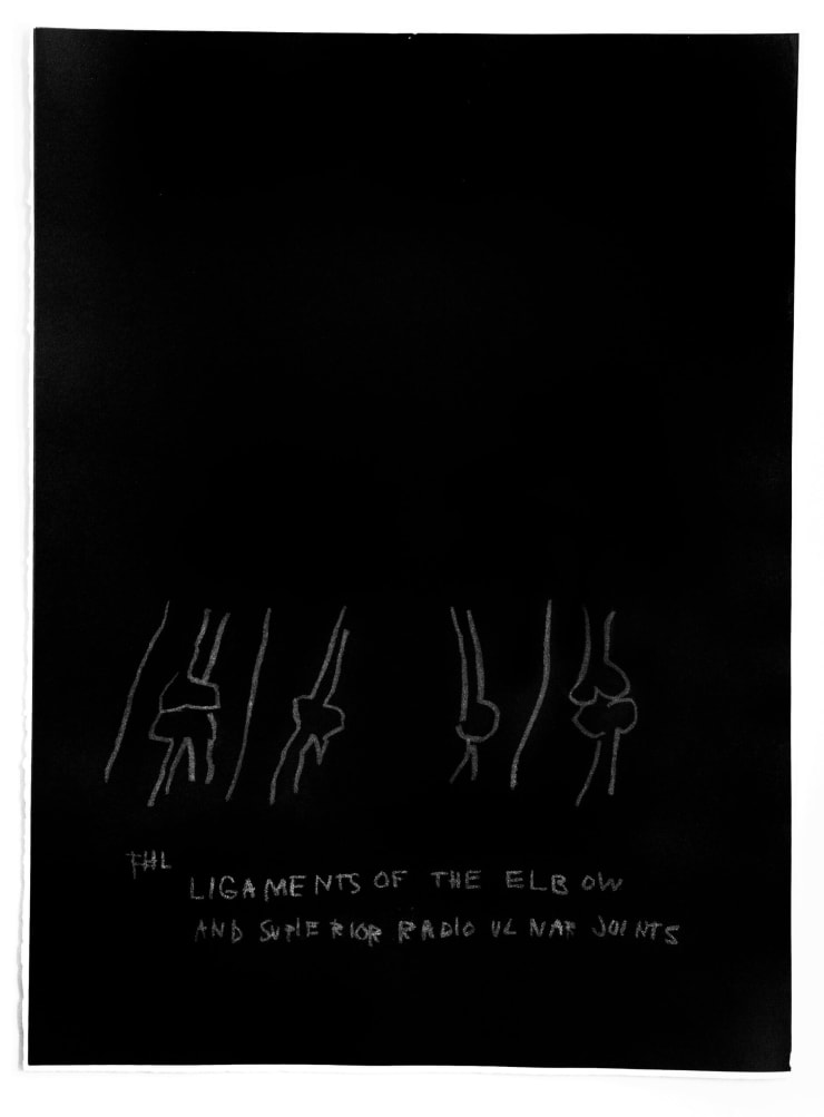 Jean Michel Basquiat “Ligaments of the Elbow” plate from the Anatomy Series” 1984 Print on Arches paper 30 x 22 in. Unsigned (Artist Proof) Authenticated This work was produced in a grey and black palette, printed before Basquiat made the color values black and white and created the iconic series of 18 plates.