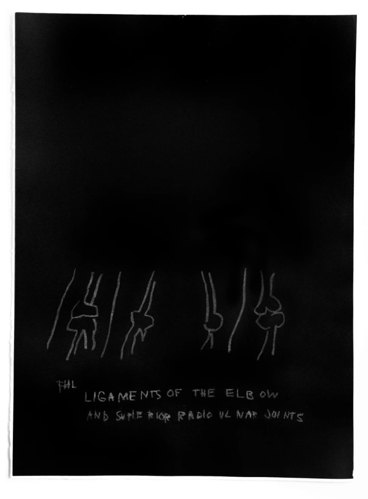 Jean-Michel Basquiat "LIGAMENTS OF THE ELBOW" PLATE FROM THE ANATOMY SERIES", 1984 Print on Arches paper 30 x 22 ins 76.2 x 55.88 cm Available at VFA