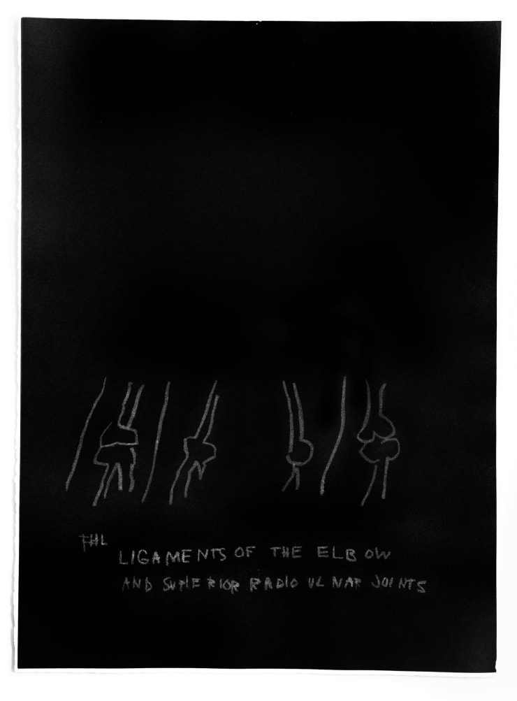 Jean Michel Basquiat “Ligaments of the Elbow” plate from the Anatomy Series, 1984 Print on Arches paper 30 x 22 in. Unsigned (Artist Proof) Authenticated This work was produced in a grey and black palette, printed before Basquiat made the color values black and white and created the iconic series of 18 plates. For sale at VFA