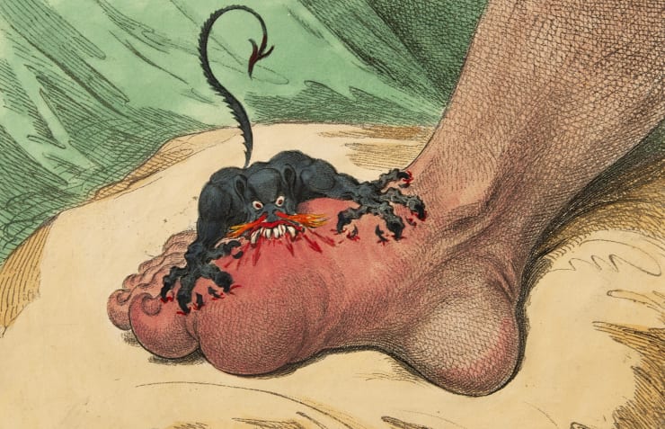 James Gillray 'Gout' Hand coloured etching